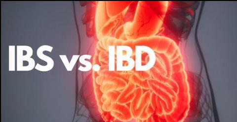 Digestive condition IBS and IBD are explained in detail by Orlando physicians at the Digestive and Liver Center of Florida.