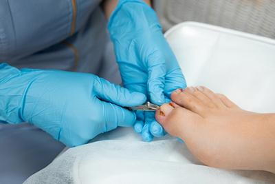 Foot specialist treating ingrown toenail