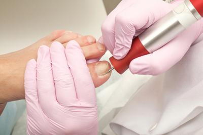 Illustration of treating ingrown with the doctor and med tools