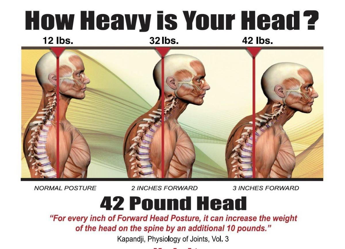 anterior-head-carriage