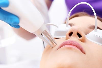 Acne-Scar-Removal-with-Laser-Treatment