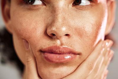 Close-up of woman’s freckled face from UV damage