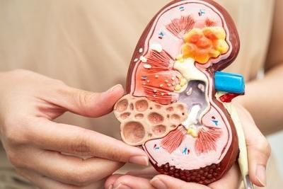 Model kidney hold by a person