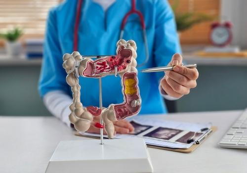 A gastroenterologist explaining the importance of colon cancer screening to a patient.