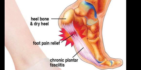 stabbing pain bottom of heel