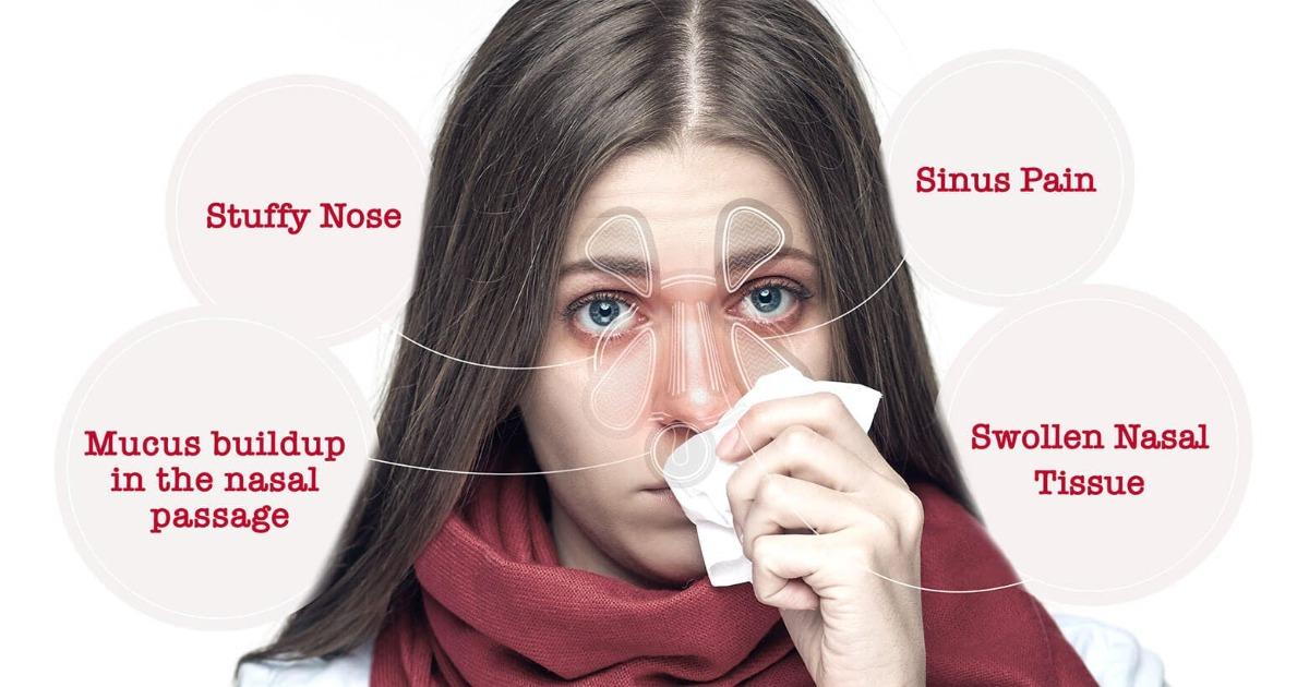 How To Help Kids With Nasal Congestion