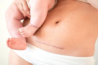 Illustration of VBAC Safety