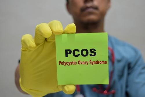 Doctor holding a card labeled PCOS – Polycystic Ovary Syndrome