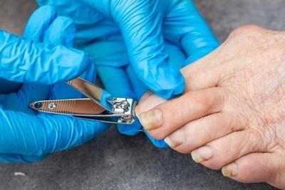 Doctor trimming toeanail on a senior person
