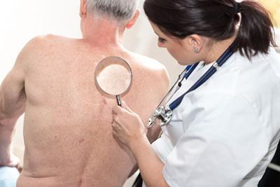 Skin-Cancer-Screening-for-Senior-Patient