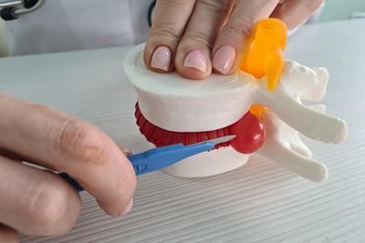 Surgeon using scalpel to show herniated disc