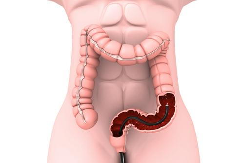 Colonoscopy visualization inside the intestine for educational purposes
