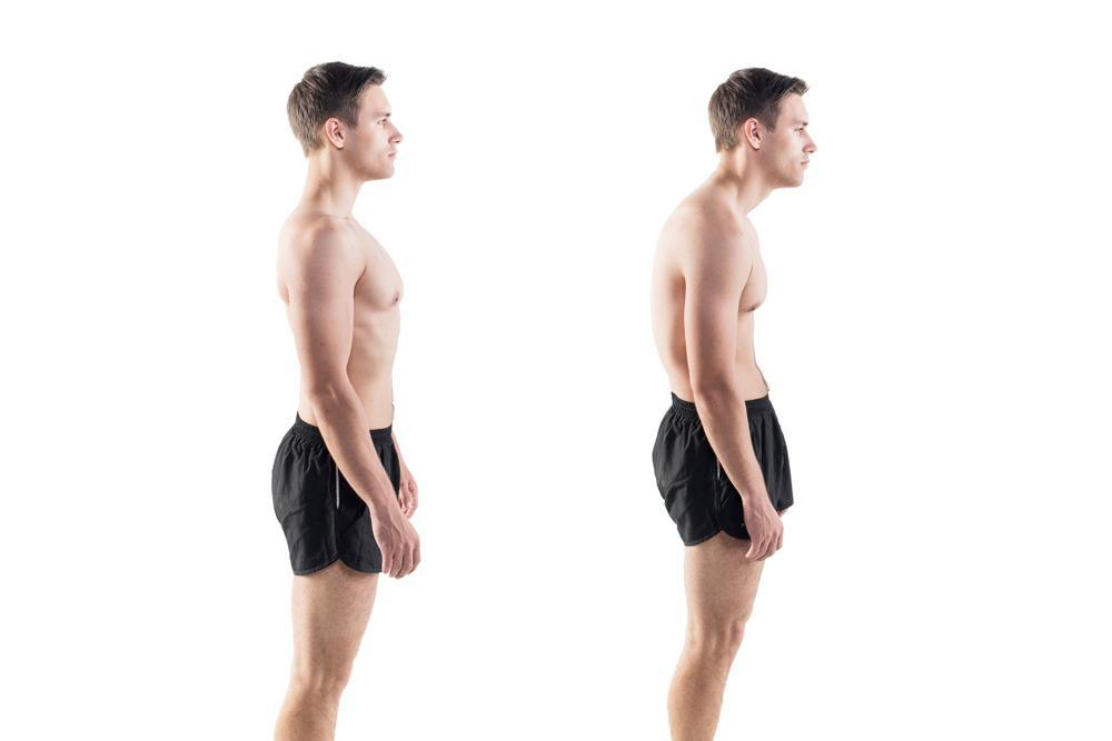 Man Impaired Posture Position