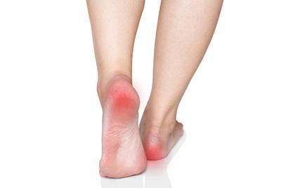 Woman with heel pain, red area indicating discomfort.