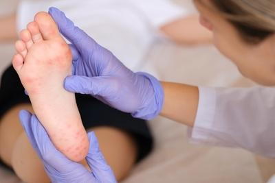 Doctor checking sole of foot showing signs of common foot problems