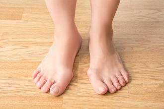 What Can I Do About Bunions