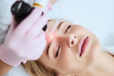 Illustration of how laser works in dermatology with the face of a flawless woman.