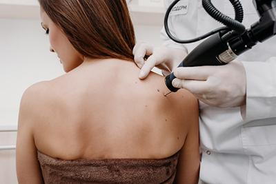 Doctor checking the mole in the back of patient