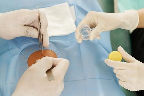 Dermatologist and assistant conducting Mohs skin cancer surgery