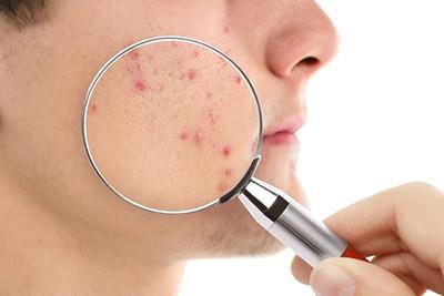 Male client receiving acne examination from a dermatologist