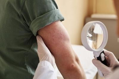 Arms of a man check by the doctor on clinic.