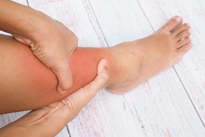 Acute-Compartment-Syndrome-on-Woman's-Legs