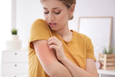 Woman scratching her arms with redness