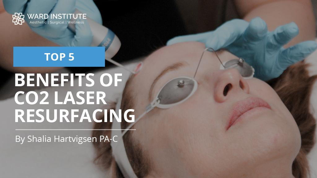 The Top 5 Benefits Of CO2 Laser Resurfacing
