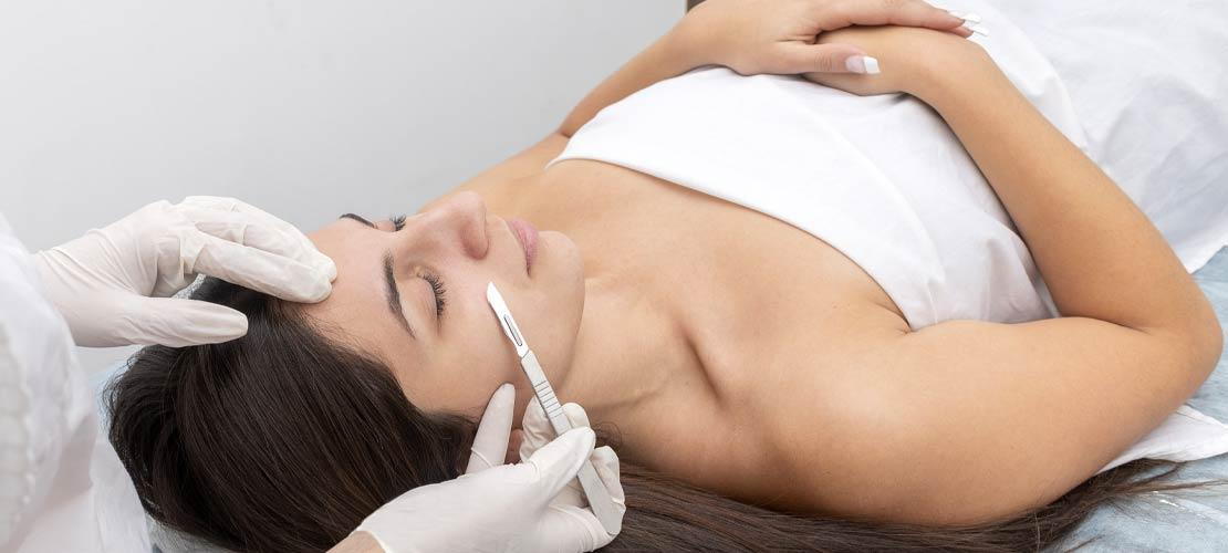 What is Dermaplaning