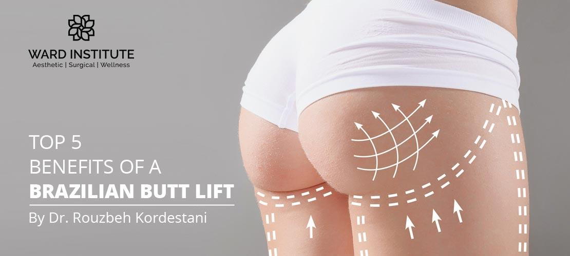 Benefits of a Brazilian Butt Lift