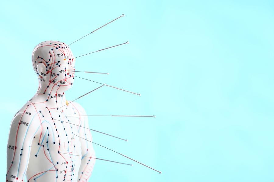 Acupuncture on a human dummy