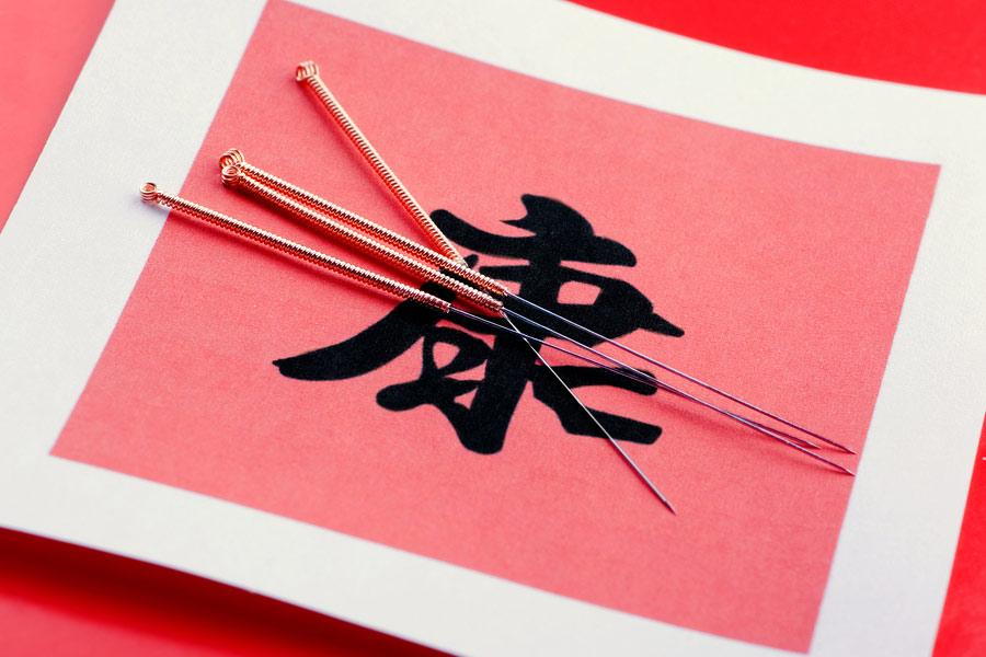 woman having acupuncture