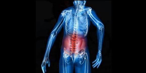 Does Spinal Stenosis Go Away?