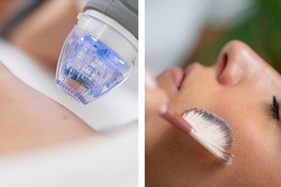 Microneedling-vs-Chemical-Peels