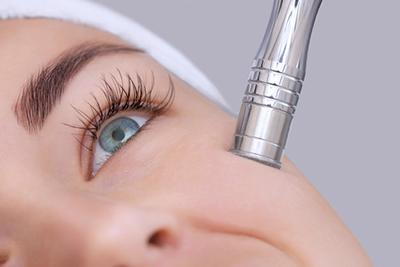 Woman-Receiving-a-Microdermabrasion-Treatment