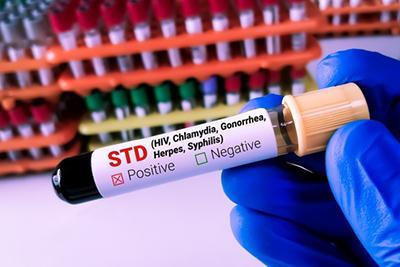 Close-Up-of-Blood-Sample-Tube-for-STD-Examination