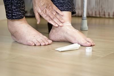 Elderly-Woman-Moisturizing-Her-Diabetic-Feet-with-Lotion
