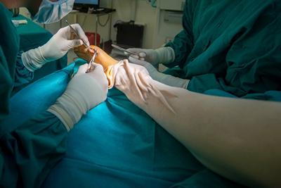Foot surgeon performing surgery