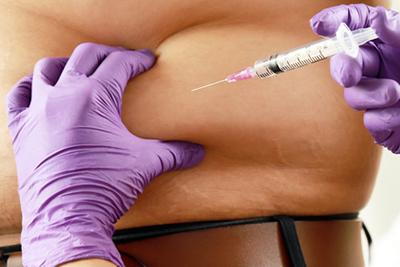 Man-Undergoing-Lipo-Shots-as-Part-of-Weight-Loss-Program