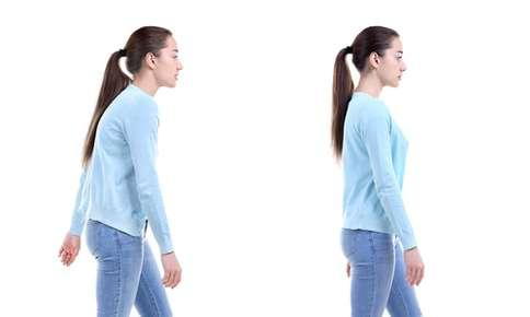 Poor Posture Can Lead to Disease. Corrective Chiropractic Care Can