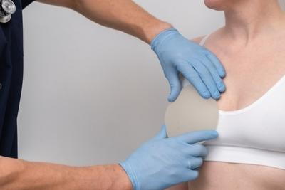 Illustration of breast augmentation on a patient procedure