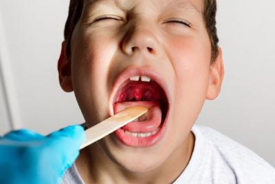 Close-up of pediatric examination of tonsils in child with tonsillitis