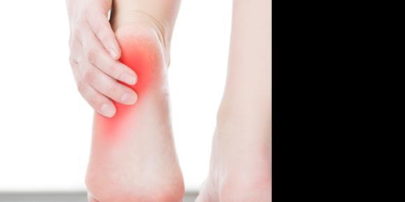 Heel Pain After Running: Why it Happens and How to Fix It