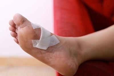 Wound on foot of patient with bondage