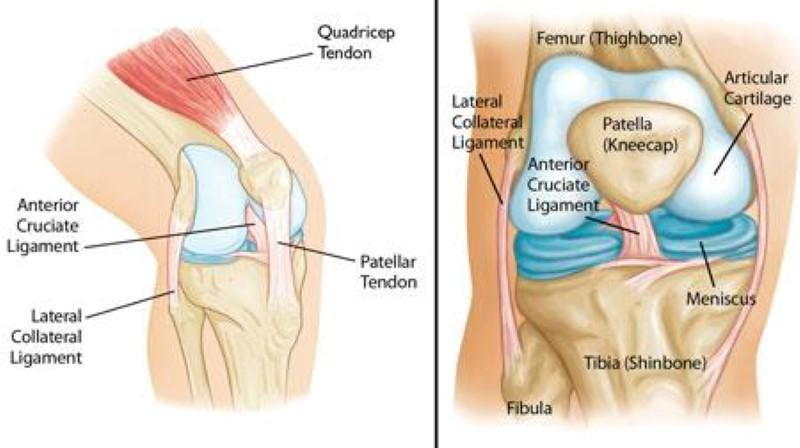 How to Correct Patellar Tracking Problem With Kinesiotape - 8 of