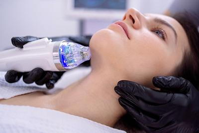 Microneedling