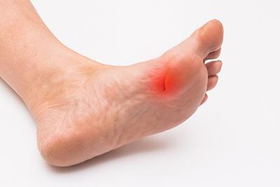 Man-has-Wound-on-his-Foot-Sole
