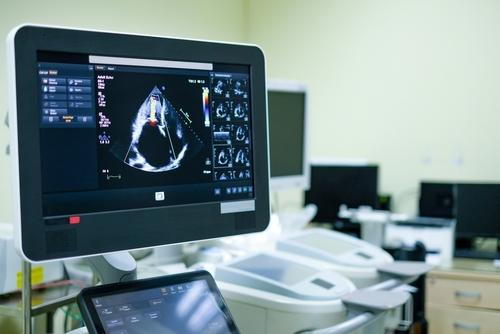 Cardiac imaging with echocardiography machine