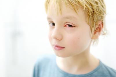 Pediatric patient with eye discomfort