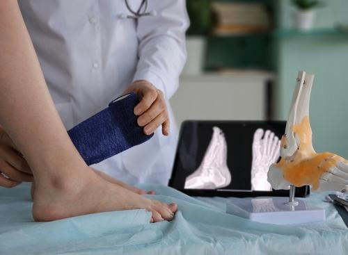 Podiatrist bandaging a sprained ankle beside an X-ray result
